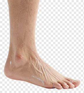 A human foot with visible skin texture.